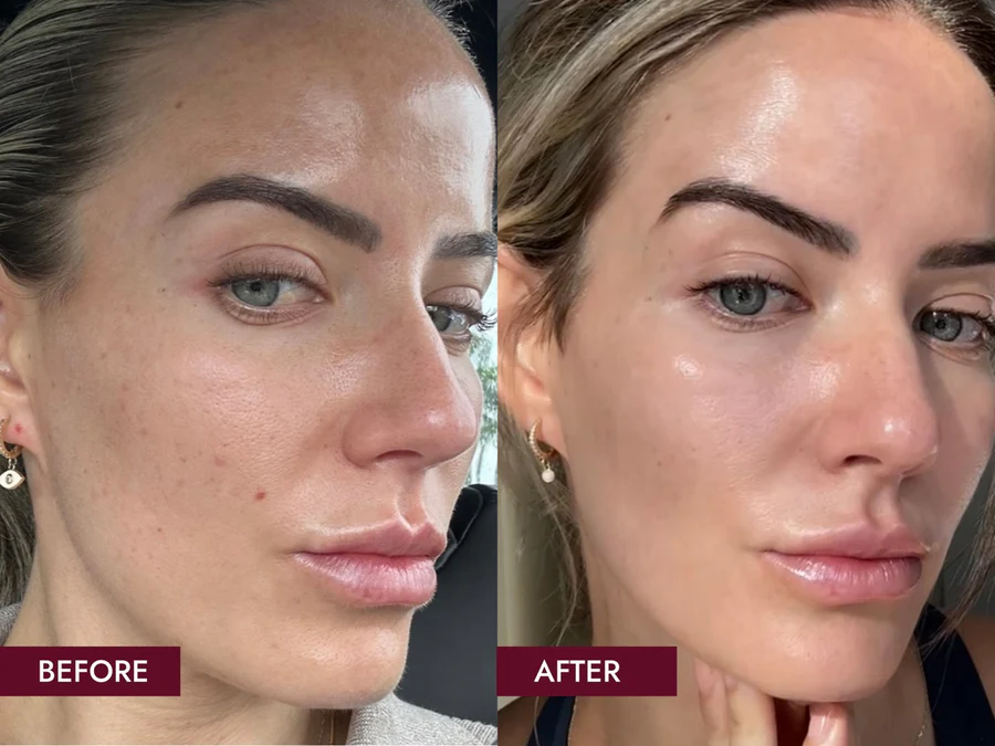sidebyside1 My Glow-Up Secret: Why VERISOL® Marine Collagen Is My New Beauty Staple