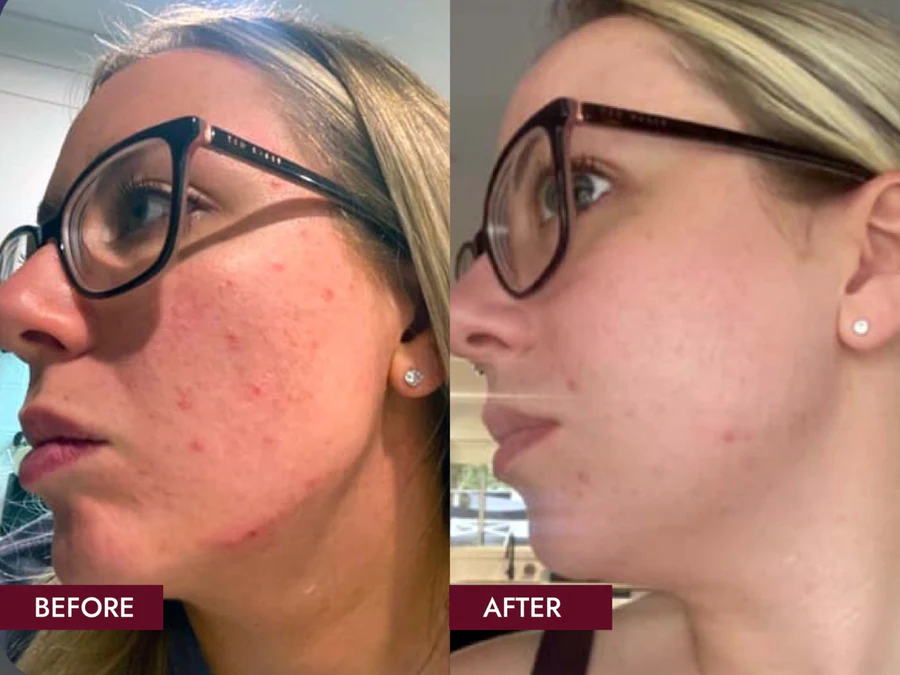 sidebyside2 My Glow-Up Secret: Why VERISOL® Marine Collagen Is My New Beauty Staple